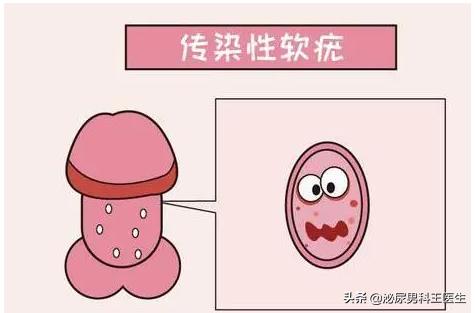 化脓性汗腺炎最新治疗进展研究综述